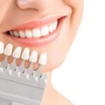 Cosmetic Dentistry and the Importance of Teeth Whitening