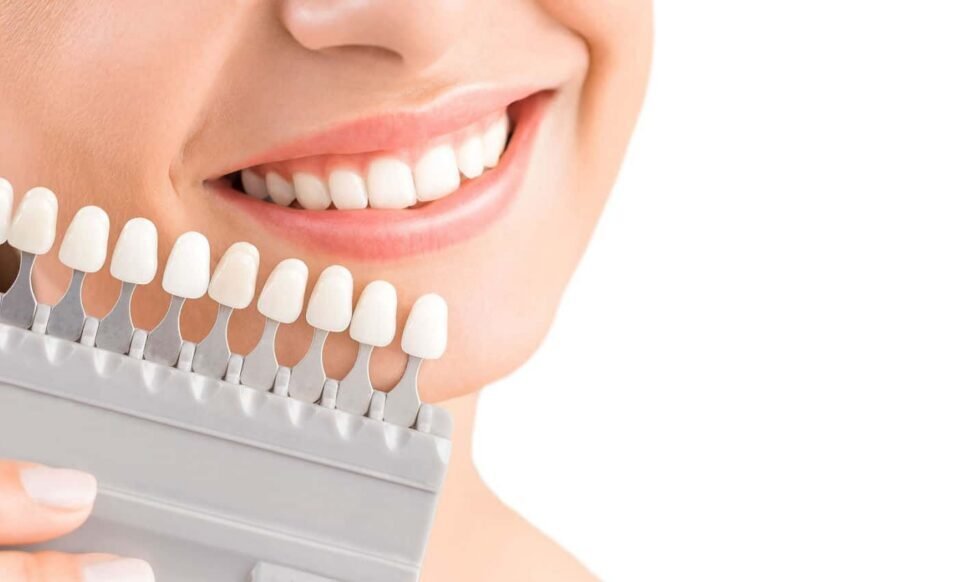Cosmetic Dentistry and the Importance of Teeth Whitening