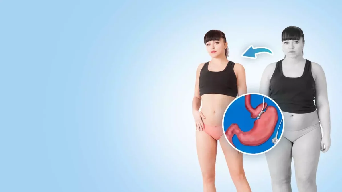 How Gastric Bypass Surgery Can Change Your Life