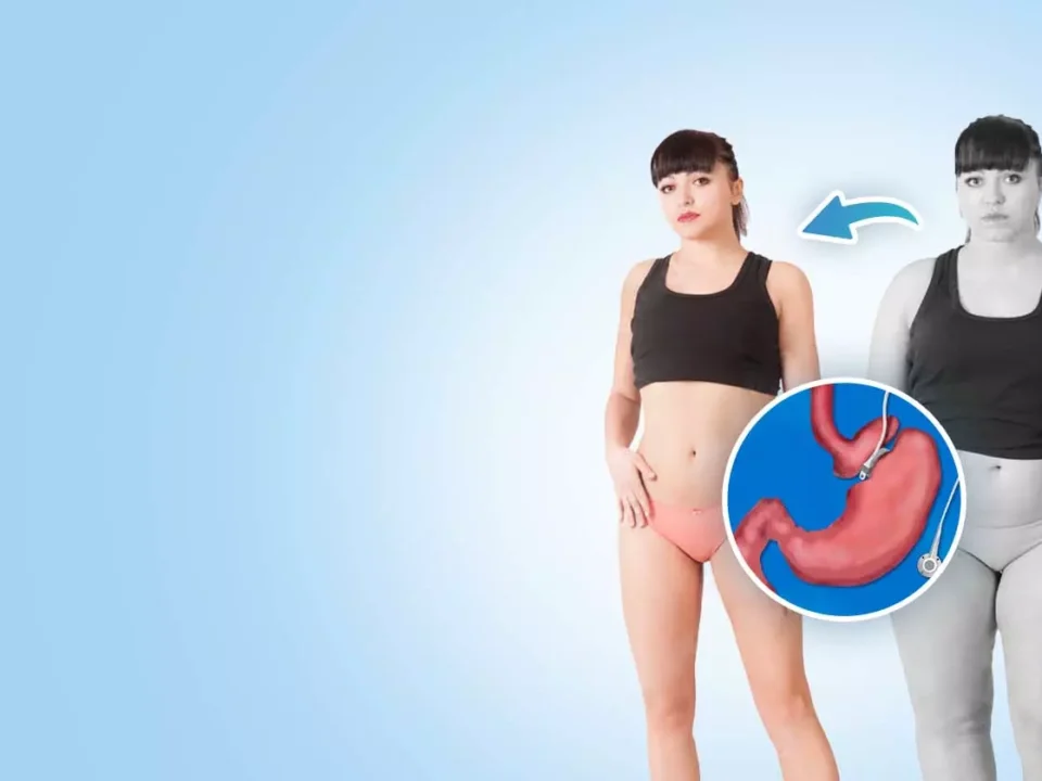 How Gastric Bypass Surgery Can Change Your Life
