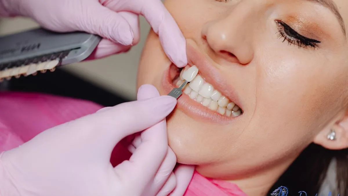 The Cost and Benefits of Dental Implants for Missing Teeth