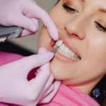 The Cost and Benefits of Dental Implants for Missing Teeth