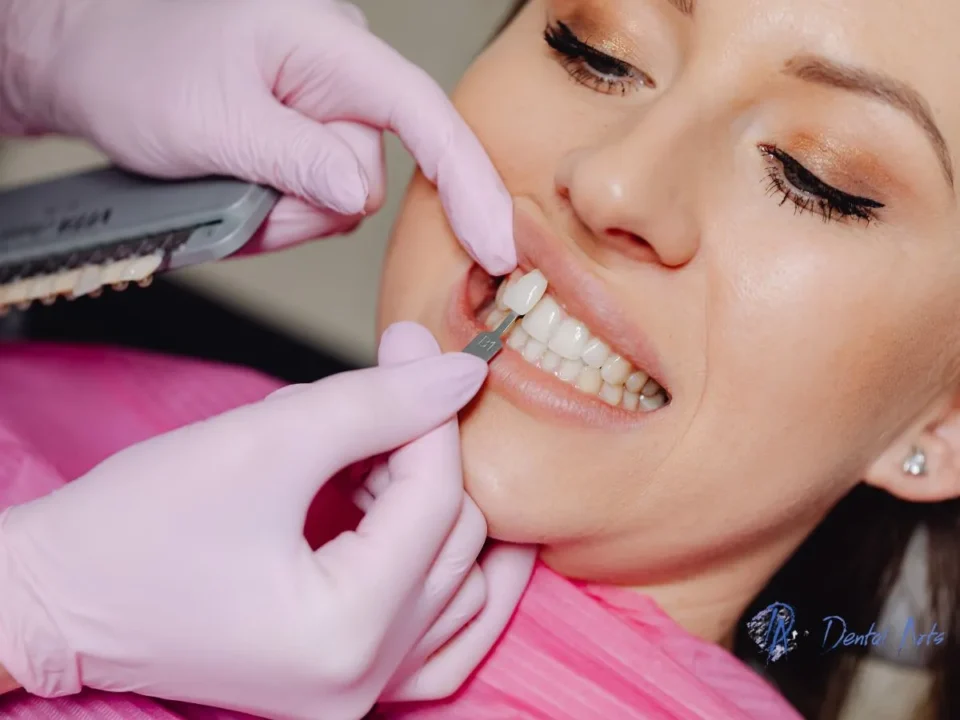 The Cost and Benefits of Dental Implants for Missing Teeth